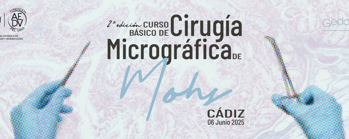 cirugia-mohs