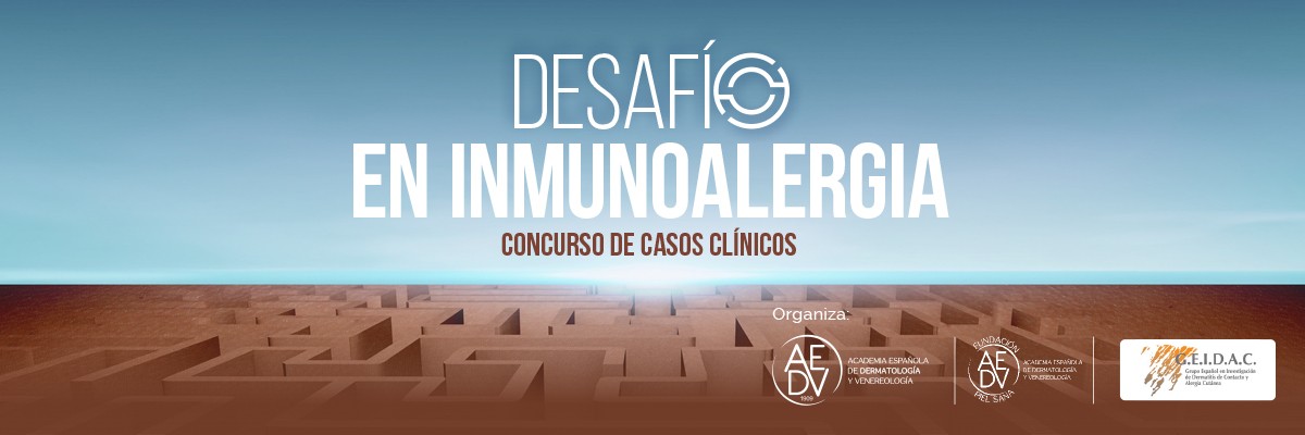 desafio-inmunoalergia