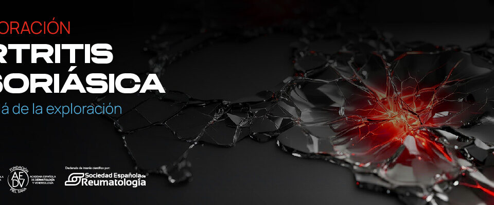 curso-artritis-psoriasica